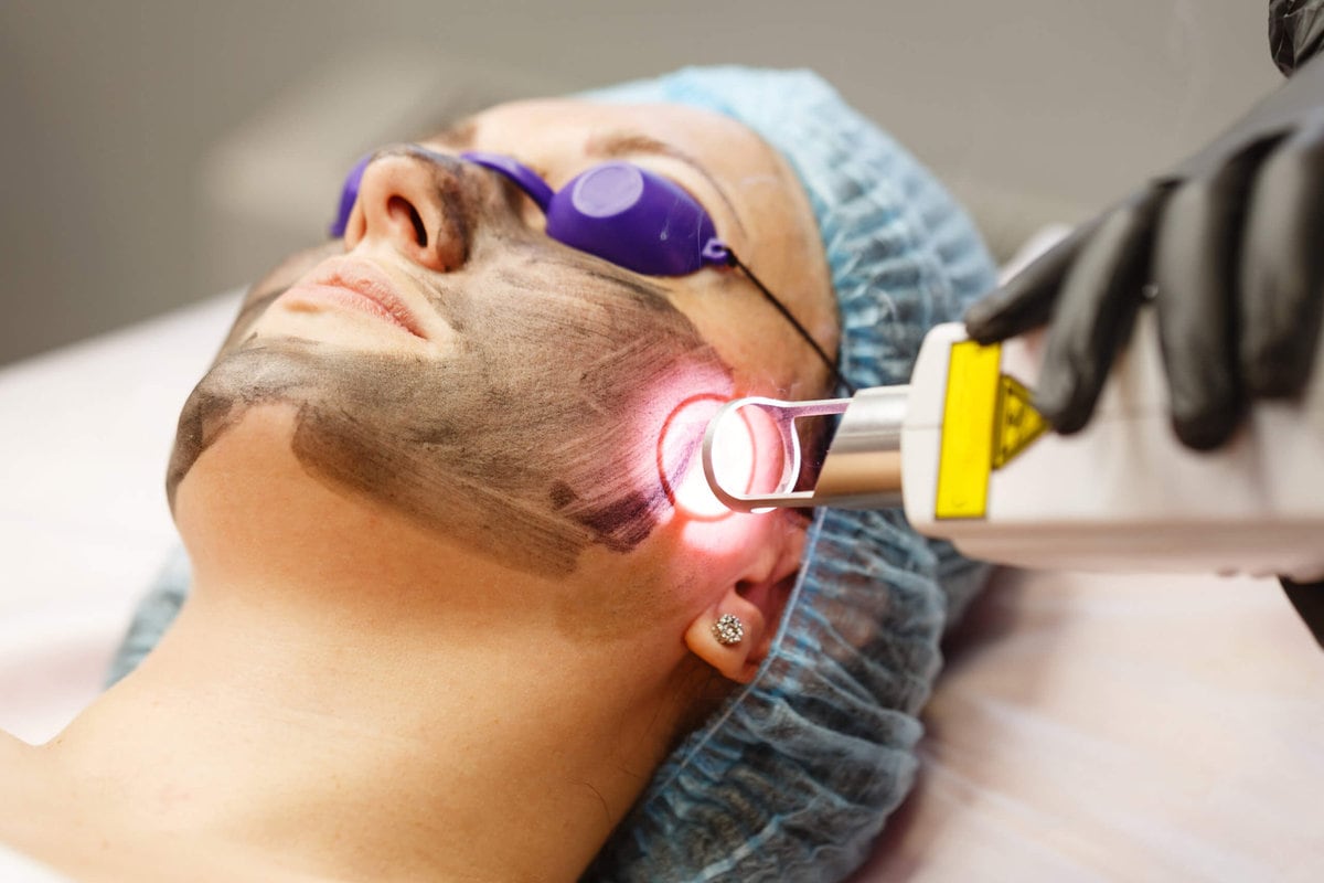 Discover the Benefits of Laser Treatments for Skin